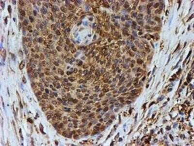 Immunohistochemistry: LMP2/PSMB9 Antibody (OTI1D1) - Azide and BSA Free [NBP2-71261]
