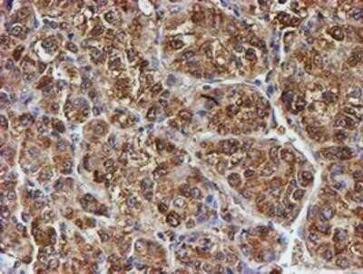 Immunohistochemistry: LMP2/PSMB9 Antibody (OTI1D1) - Azide and BSA Free [NBP2-71261]