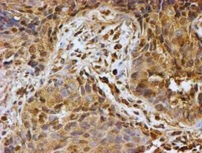 Immunohistochemistry: LMP2/PSMB9 Antibody (OTI1D1) - Azide and BSA Free [NBP2-71261]