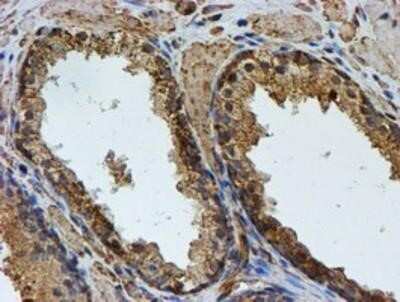 Immunohistochemistry: LMP2/PSMB9 Antibody (OTI1D1) - Azide and BSA Free [NBP2-71261]