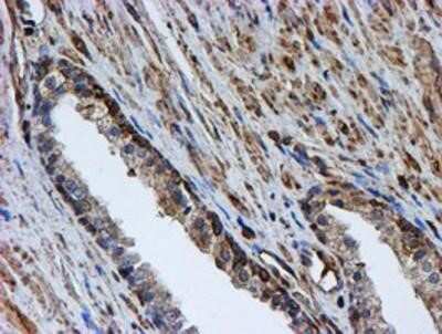 Immunohistochemistry: LMP2/PSMB9 Antibody (OTI1D1) - Azide and BSA Free [NBP2-71261]