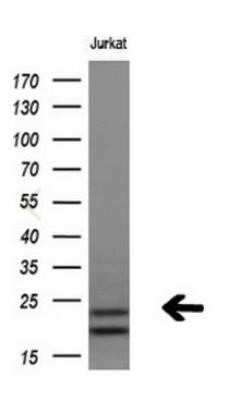 Western Blot: LMP2/PSMB9 Antibody (OTI1D1)Azide and BSA Free [NBP2-71261]
