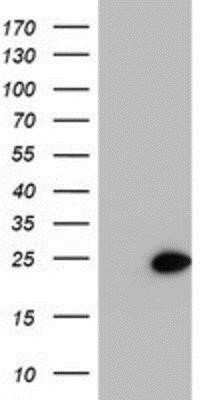 Western Blot: LMP2/PSMB9 Antibody (OTI1D1)Azide and BSA Free [NBP2-71261]