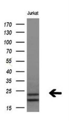 Western Blot: LMP2/PSMB9 Antibody (OTI1D1) [NBP2-01817]