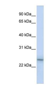 Western Blot: LMP2/PSMB9 Antibody [NBP1-58331]