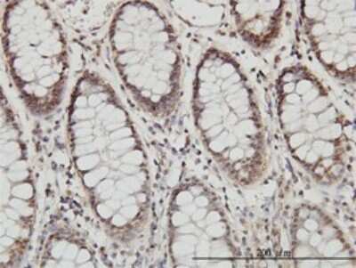Immunohistochemistry-Paraffin: LMP7/PSMB8 Antibody (1B3) [H00005696-M01]