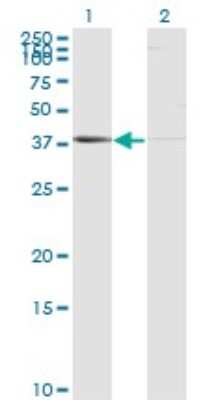 Western Blot: LMP7/PSMB8 Antibody (1B3) [H00005696-M01]