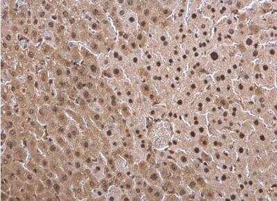 Immunohistochemistry-Paraffin: LMP7/PSMB8 Antibody [NBP1-33540]