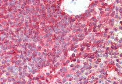 Immunohistochemistry-Paraffin: LMP7/PSMB8 Antibody [NBP1-51957]