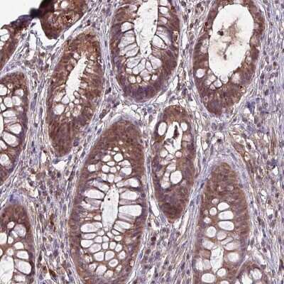 Immunohistochemistry-Paraffin: LMP7/PSMB8 Antibody [NBP2-47395]