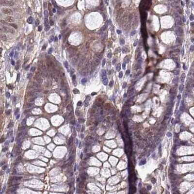 Immunohistochemistry-Paraffin: LMP7/PSMB8 Antibody [NBP2-47395]
