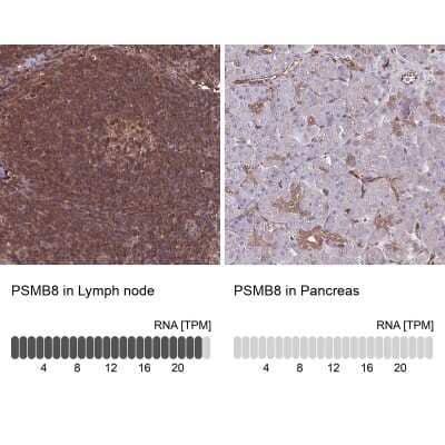 Immunohistochemistry-Paraffin: LMP7/PSMB8 Antibody [NBP2-47396]