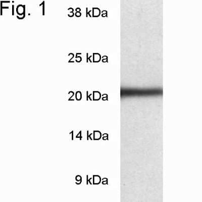 Western Blot: LMP7/PSMB8 Antibody [NB120-3329]