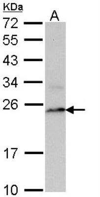 Western Blot: LMP7/PSMB8 Antibody [NBP1-33540]