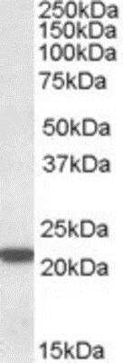 Western Blot: LMP7/PSMB8 Antibody [NBP1-51957]