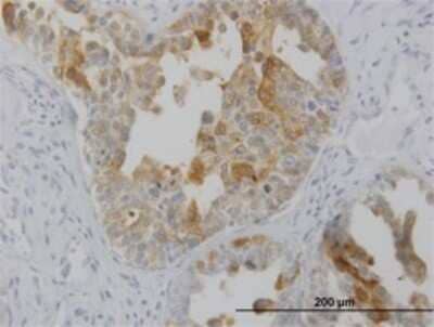 Immunohistochemistry-Paraffin: LMTK2 Antibody (3G1) [H00022853-M02]