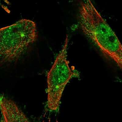 Immunocytochemistry/ Immunofluorescence: LMTK2 Antibody [NBP2-58981]