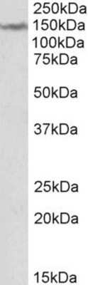 Western Blot: LMTK2 Antibody [NBP1-52082]