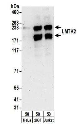 Western Blot: LMTK2 Antibody [NBP2-32182]