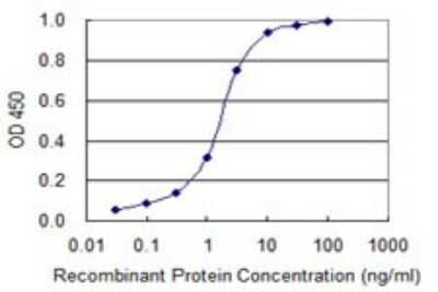 ELISA: LMTK3 Antibody (2H6) [H00114783-M02]