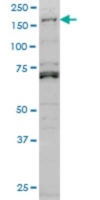 Western Blot: LMTK3 Antibody (2H6) [H00114783-M02]