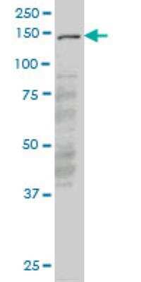 Western Blot: LMTK3 Antibody (6C5) [H00114783-M03]