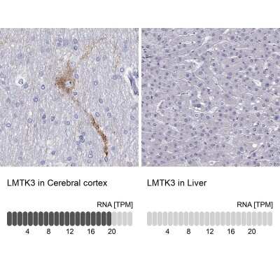 Immunohistochemistry-Paraffin: LMTK3 Antibody [NBP2-62711]