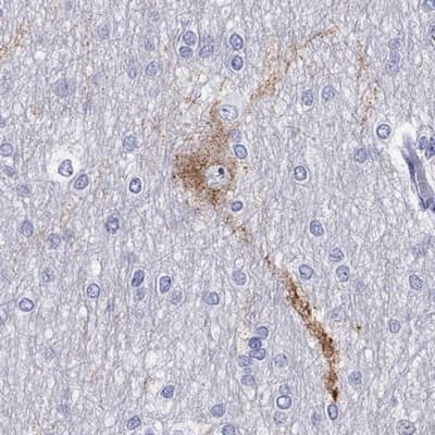 Immunohistochemistry-Paraffin: LMTK3 Antibody [NBP2-62711]