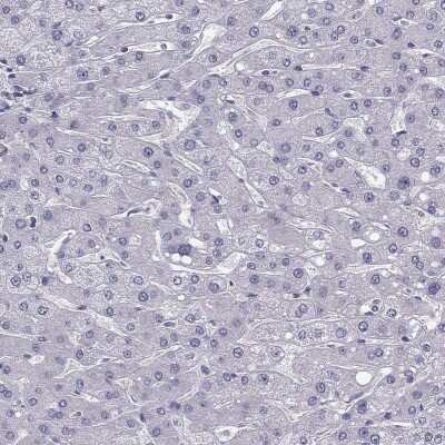 Immunohistochemistry-Paraffin: LMTK3 Antibody [NBP2-62711]