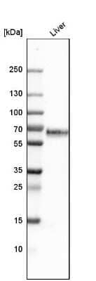 Western Blot: Kininogen Antibody [NBP1-89994]