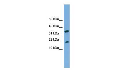 Western Blot: LMW-PTP/ACP1 Antibody [NBP1-55482]