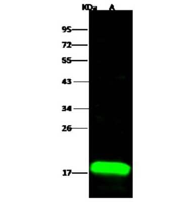 Western Blot: LMW-PTP/ACP1 Antibody [NBP2-99671]