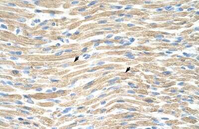 Immunohistochemistry: LMX1A Antibody [NBP2-84141]