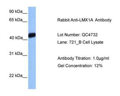 Western Blot: LMX1A Antibody [NBP2-84140]