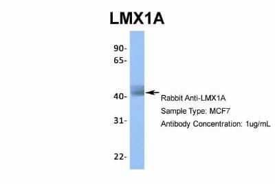 Western Blot: LMX1A Antibody [NBP2-84141]