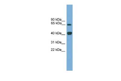 Western Blot: LMX1A Antibody [NBP2-84143]