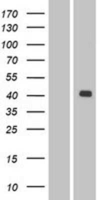 Western Blot: LMX1A Overexpression Lysate [NBP2-05029]