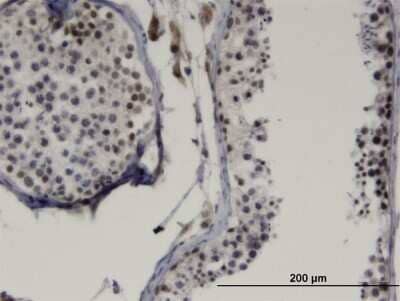 Immunohistochemistry-Paraffin: LMX1b Antibody (1D12) [H00004010-M08]