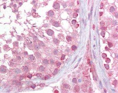 Immunohistochemistry-Paraffin: LMX1b Antibody [NBP1-36970]