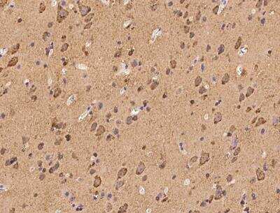 Immunohistochemistry-Paraffin: LMX1b Antibody [NBP3-06531]