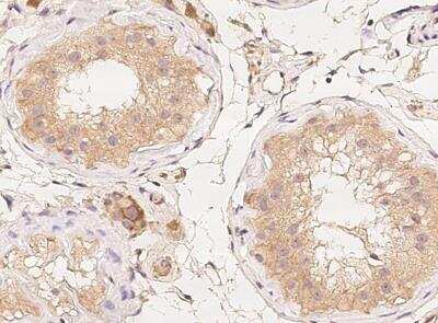 Immunohistochemistry-Paraffin: LMX1b Antibody [NBP3-06531]