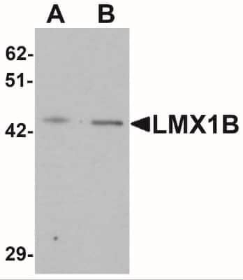 Western Blot: LMX1b AntibodyBSA Free [NBP2-41194]