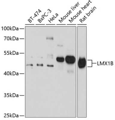 Western Blot: LMX1b AntibodyBSA Free [NBP3-03914]