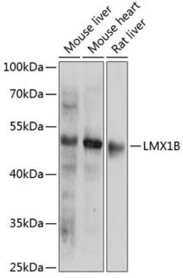 Western Blot: LMX1b AntibodyBSA Free [NBP3-03915]