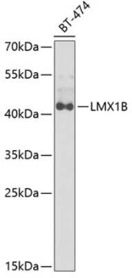 Western Blot: LMX1b AntibodyBSA Free [NBP3-04700]