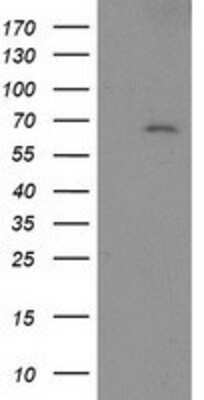 Western Blot: LNK/SH2B3 Antibody (OTI2D8) [NBP2-00641]