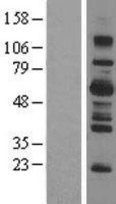 Western Blot: LNK/SH2B3 Overexpression Lysate [NBL1-15917]