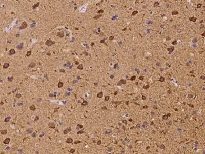Immunohistochemistry: LNK/SH2B3 Antibody [NBP3-06063]