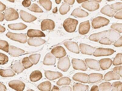 Immunohistochemistry-Paraffin: LNK/SH2B3 Antibody [NBP3-06063]