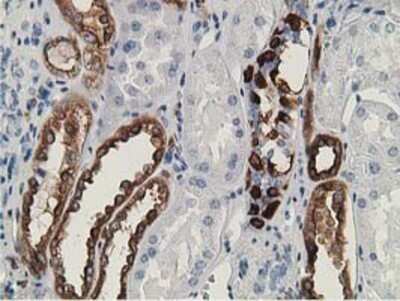Immunohistochemistry: LNK/SH2B3 Antibody (OTI2D8) - Azide and BSA Free [NBP2-72514]
